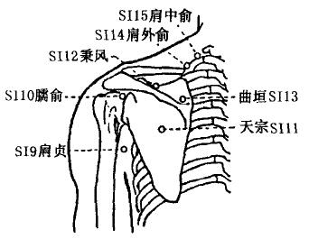 Tianzong(SI11)