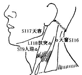 Tianchuang(SI16)