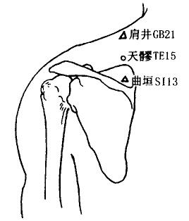 Tianliao(TE15)