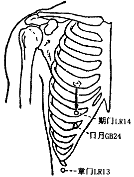 Zhangmen(LR13)