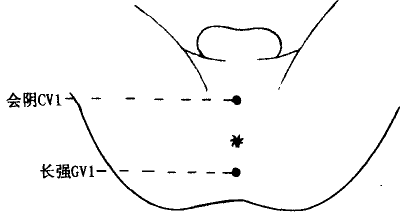 Huiyin(CV1)