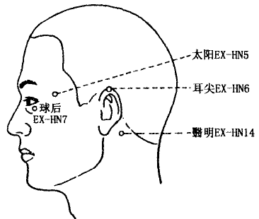 Taiyang(EX-HN5)