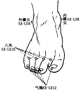 Qiduan(EX-LE12)